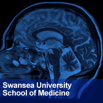 Swansea University Medical School: Neuroscience