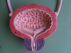 Internal bladder