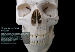 Inferior Orbital Fissure Inferior Orbital Fissure