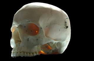 Anterior-Lateral Skull