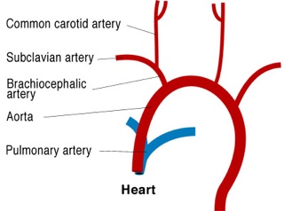 Aortic Arches 03